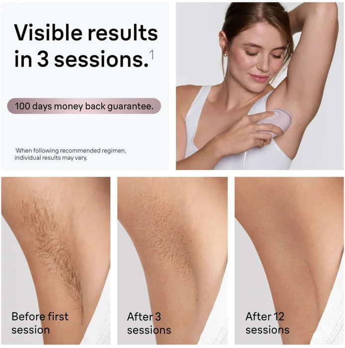 Photoepilator BRAUN IPL PL1111 NUMBER OF IMPULSES 300000, PINK