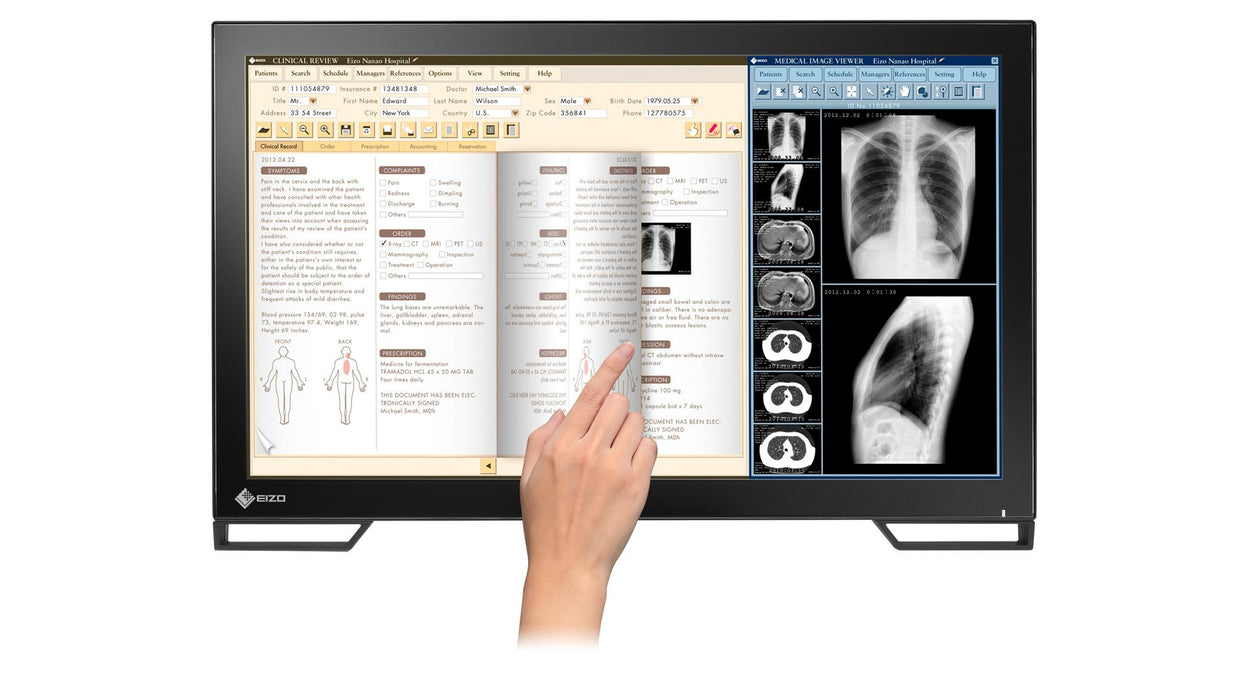 Medical monitor EIZO RadiForce MS236WT 2MP Color, Touch