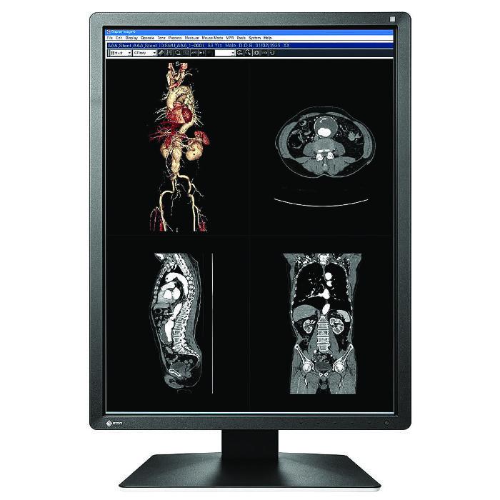 Medical monitor EIZO RadiForce MX216-HB 2MP Color