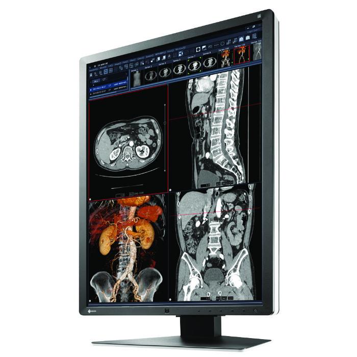 Medical monitor EIZO RadiForce RX250 2MP Color