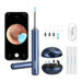Smart Visual Ear-Clean Rod Bebird M9 S (blue) - Otoscopes<<<Health and beauty<<<InnproXML