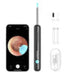 Smart Visual Ear-Clean Rod Bebird R1 black - Otoscopes<<<Health and beauty<<<InnproXML