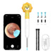 Smart Visual Ear-Clean Rod Xlife Q3 (yellow) - Otoscopes<<<Health and beauty<<<InnproXML
